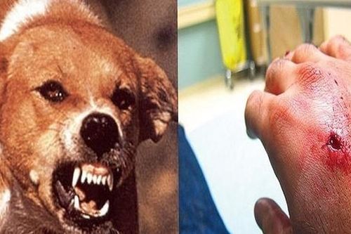 Trong một buổi chiều, 3 người bị chó dại cắn
