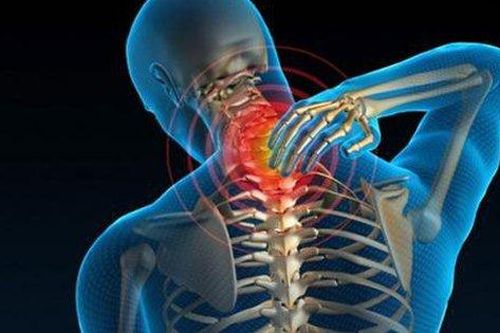 Thoái hóa xương khớp sớm nếu bạn thường xuyên có những thói quen này