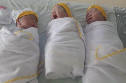 Sản phụ sinh 3 sau 8 năm hiếm muộn