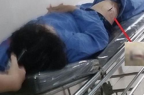 Đối tượng đâm cán bộ Cục thuế Ninh Bình khai gì tại cơ quan Công an?