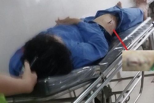 Lời khai bất ngờ của kẻ rút dao đâm cán bộ Thuế