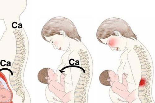 Vì sao phụ nữ sau sinh bị loãng xương?