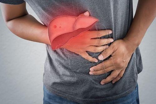 Thảo dược tốt cho người gan nhiễm mỡ