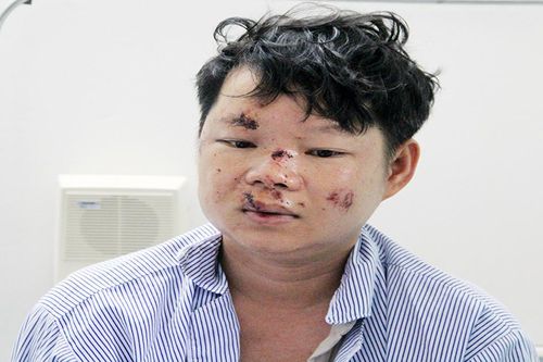 Vụ xe tải lật làm 4 người chết ở Phú Yên: Tài xế cố lánh nạn nhưng bất thành