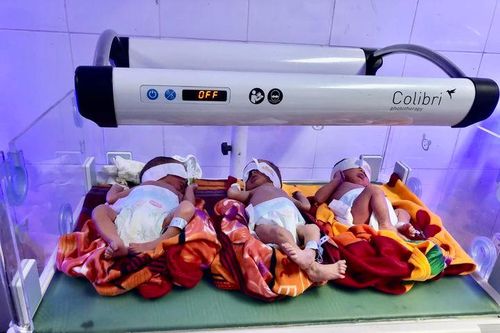 Sản phụ sinh 3 sau 8 năm hiếm muộn