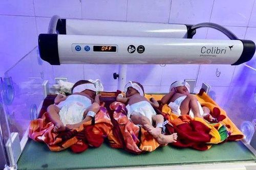 Sản phụ sinh 3 cùng trứng sau nhiều năm khó có con