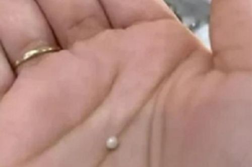 Đang ăn tối, cô gái cắn ngay được viên ngọc quý giá lên đến hàng ngàn USD