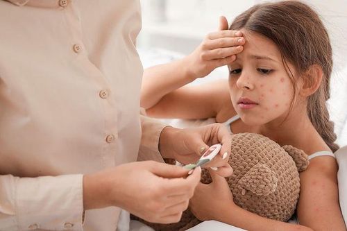 8 điều cha mẹ cần biết về bệnh thủy đậu