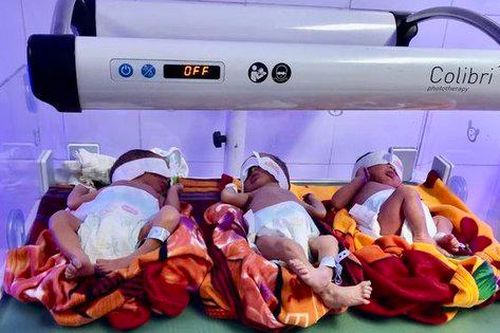 Mổ đẻ thành công cho sản phụ sinh ba cùng trứng hiếm gặp