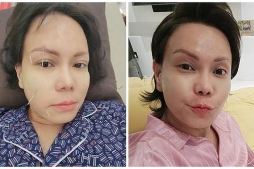 Việt Hương bị méo mặt, giờ thế nào?