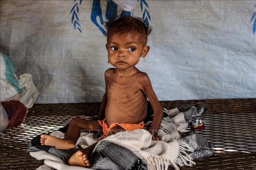 Cảnh báo về tình trạng trẻ em suy dinh dưỡng nghiêm trọng tại khu vực Sahel