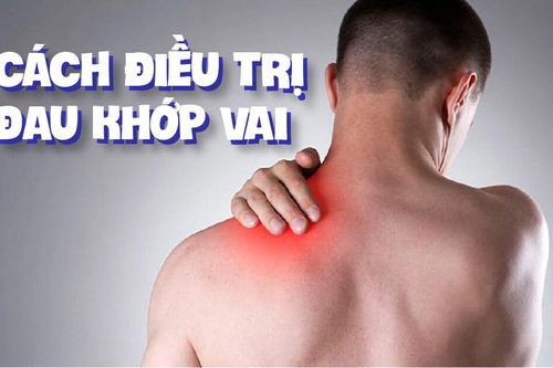 Nguyên nhân và cách phòng ngừa đau khớp vai