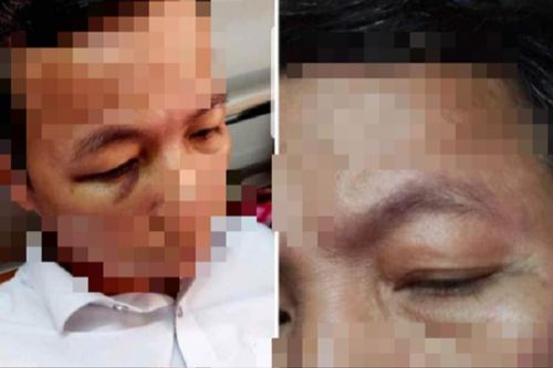 Thầy hiệu trưởng đấm hiệu phó nhập viện