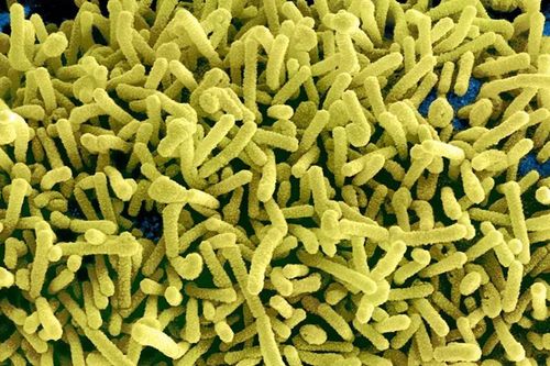 Mỹ cảnh báo nguy cơ virus Marburg lây lan từ châu Phi