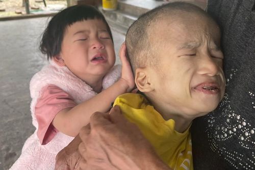 Cha mẹ bất lực chứng kiến con thơ gào thét vì mù mắt, bại não bẩm sinh