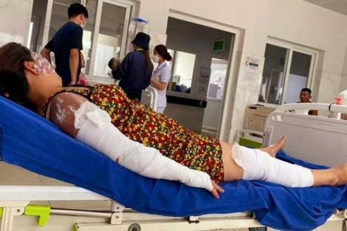Đắk Lắk: Bình gas mini phát nổ trong lúc nấu lẩu, 7 người bị thương