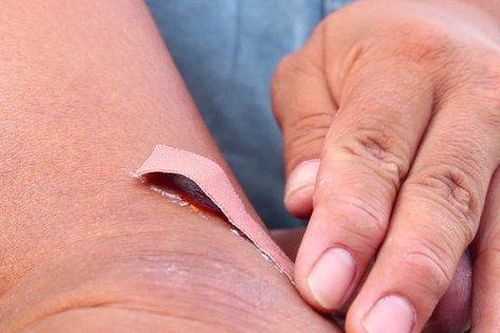 Người đàn ông bị nhiễm khuẩn uốn ván từ sợi dây thép cọ vào chân