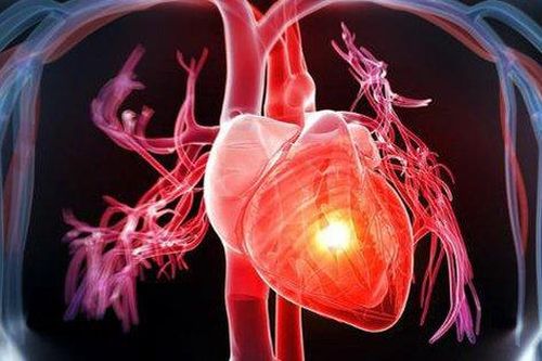 Biện pháp tại nhà làm giảm cholesterol cao