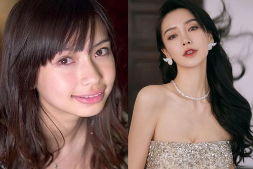 Bị xử phạt vì gọi Angelababy là 'cô gái răng vẩu'