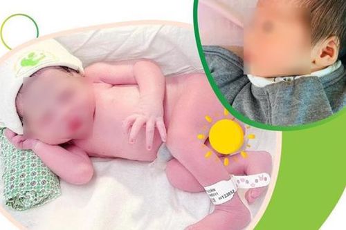 Hà Nội: Một bé gái chào đời khỏe mạnh từ người mẹ ghép thận