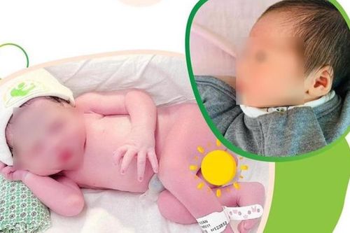 Bé gái chào đời khỏe mạnh từ người mẹ ghép thận
