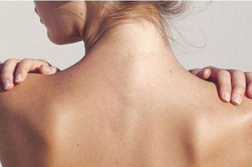 Bí quyết làm đẹp vùng da lưng