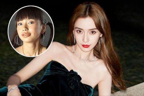 Cái giá phải trả khi gọi Angelababy là 'cô gái răng vẩu'