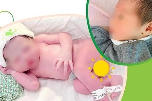 Em bé chào đời khỏe mạnh từ người mẹ ghép thận