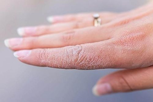Dấu hiệu cảnh báo cơ thể thiếu vitamin A