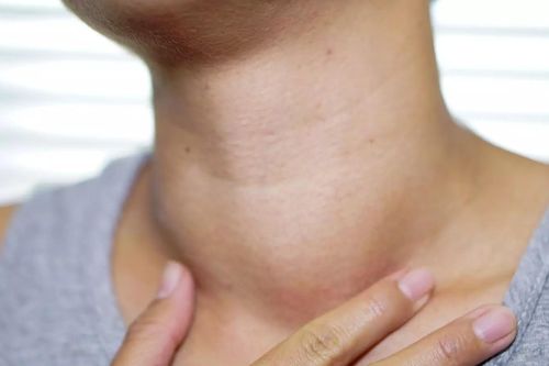 Số người mắc ung thư tuyến giáp ngày càng tăng