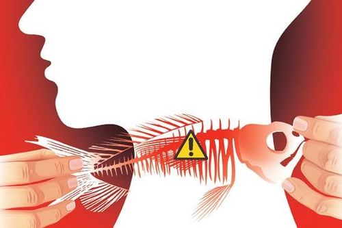 Hóc xương cá không còn là vấn đề đáng sợ nếu bạn biết mẹo vặt này