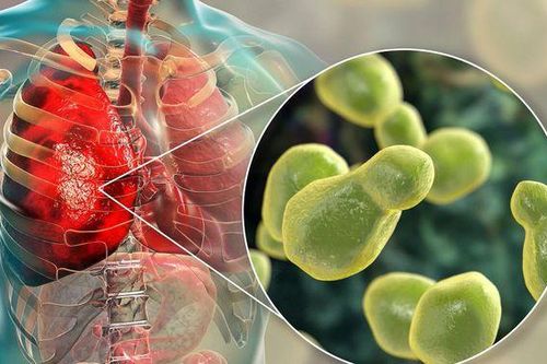 Các loại nấm gây viêm phổi và cách phòng ngừa
