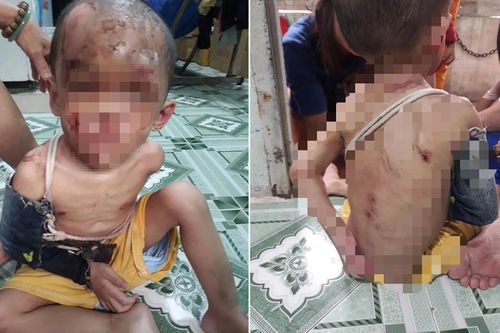Vụ bé trai nghi bị cha mẹ ruột bạo hành ở Hóc Môn: Hội BVQTE TPHCM chính thức lên tiếng