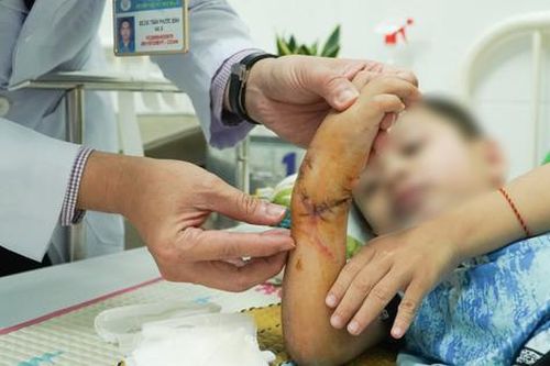 7 giờ phẫu thuật cứu cánh tay bé 5 tuổi bị đứt lìa do tai nạn giao thông