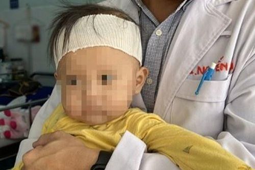 Bé gái 10 tháng tuổi hóc xương khi ăn cháo lươn