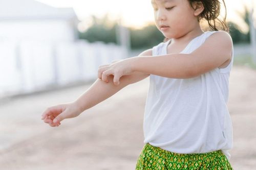 Nguyên nhân trẻ bị dị ứng da