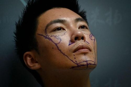 Bộ phận cơ thể đàn ông phẫu thuật thẩm mỹ nhiều nhất