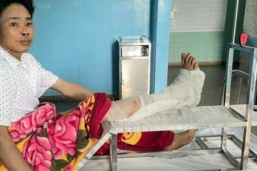 Nối thành công bàn chân người đàn ông bị đứt lìa do máy cắt cỏ