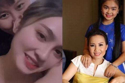 Gương mặt khác lạ của quán quân The Voice Kids - Thiện Nhân, dân mạng nhận xét như 'can thiệp dao kéo'