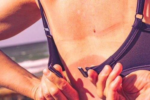 Người da ngăm ít bị ung thư da hơn?