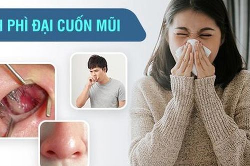 Ngạt mũi liên tục gây khó thở, khó ngủ: nguyên nhân và cách điều trị