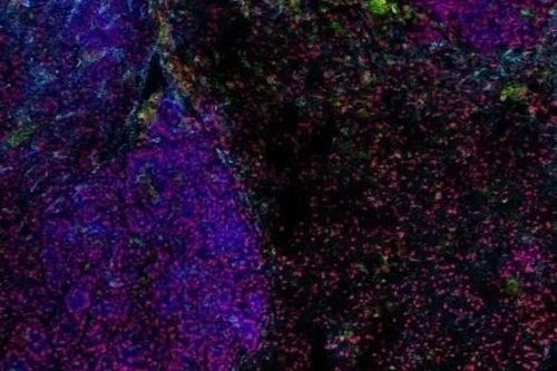 Tìm thấy loại virus cổ có thể là chìa khóa để điều trị ung thư phổi