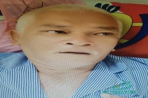 Hoàn cảnh đáng thương của bệnh nhân bị tai nạn giao thông