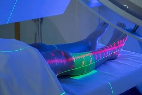 Điều trị Sarcoma mô mềm ở các chi