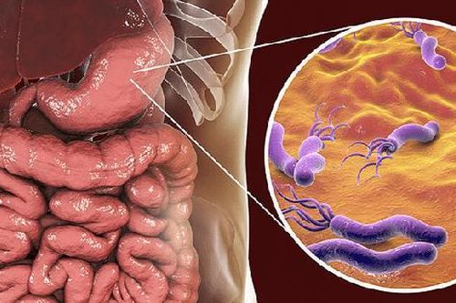 Dùng thuốc trung hòa acid trong điều trị viêm loét dạ dày do vi khuẩn H.Pylori