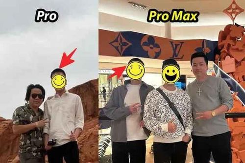 Khoa Pug tự tay đăng ảnh trước và sau khi kéo chân 5 tỷ