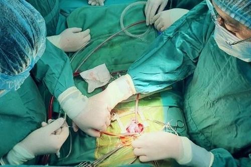Bệnh nhi 20 ngày tuổi trải qua 4 cuộc đại phẫu