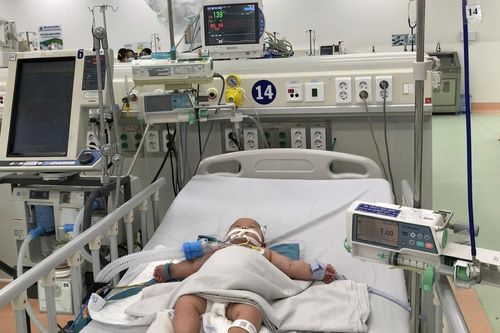 Cứu sống bệnh nhi ngưng thở, trụy tim mạch do mắc sốt xuất huyết
