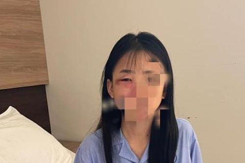 Hà Nội: Nữ sinh lớp 8 nghi bị đánh hội đồng đến nhập viện
