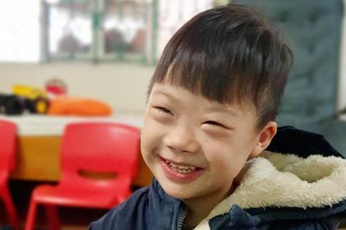 Dù không như bao em bé khác nhưng bố mẹ vẫn yêu những điều chưa hoàn hảo của con